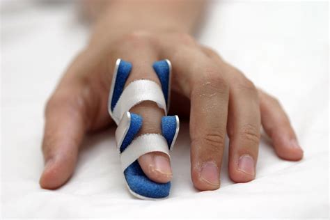 broken knuckle symptoms  sprain  betty heard blog