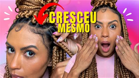 Trança Faz O Cabelo Crescer
