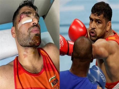 indian boxer satish kumar win fans heart   fights   stiches