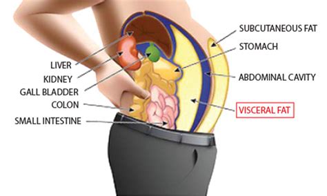 What's Visceral Fat? - Ashislim Natural and Effective Weight Loss ...