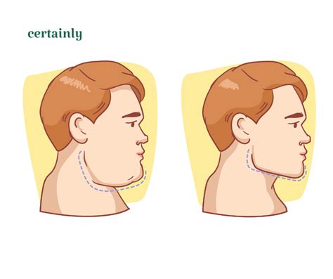 Benefits & Risks of Masseter Botox for TMJ Disorder | Certainly Health