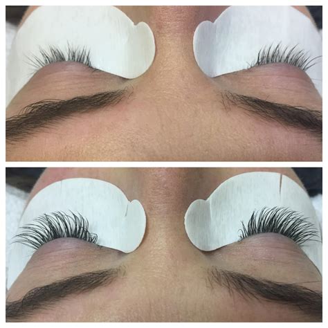 xtreme lashes eyelash extensions eden spa  laser