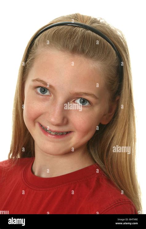 Young girl with dental braces on her teeth isolated on white Stock ...