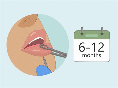 how to know if your piercing is rejecting