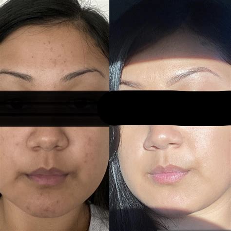 5363 best Skincare Routine images on Pholder | Skincare Addiction, SC