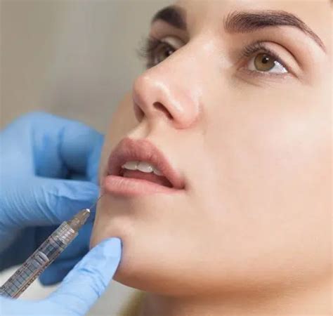 Belfast Lip Fillers | Dermal Fillers | Lip Augmentation | Injections