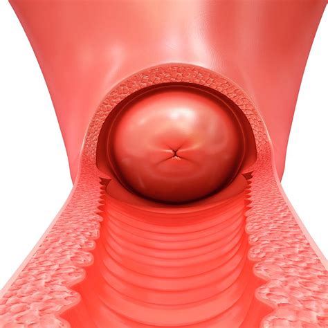 Female Vagina And Cervix Photograph by Science Photo Library - Pixels