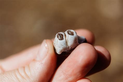 how to get rid of barnacles