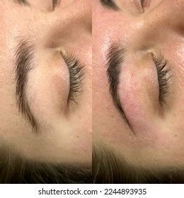 Before After Eyebrow Wax Stock Photo 2244893935 | Shutterstock