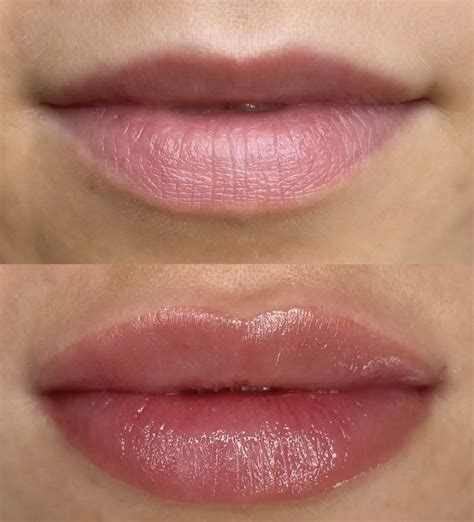 Transform Your Look: Combine Lip Tattoos with Other Procedures