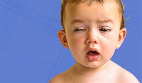 penyebab mata bayi berair ibu  ayah wajib tahu