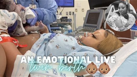 THE LIVE BIRTH OF OUR SECOND SET OF TWINS | *Real, Raw & Emotional ...