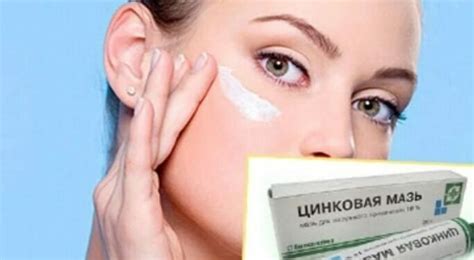Цинковая мазь для лица против прыщей и пигментных пятен