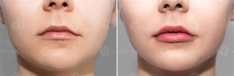 Female lips after permanent makeup lip blushing procedure 14346512