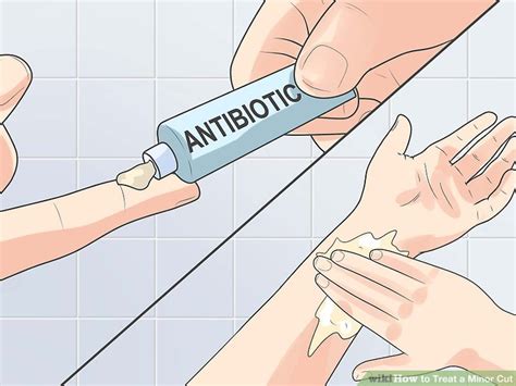 how to treat an open cut