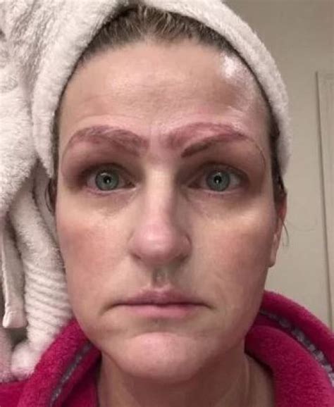 single mum dumped  botched  microblading left