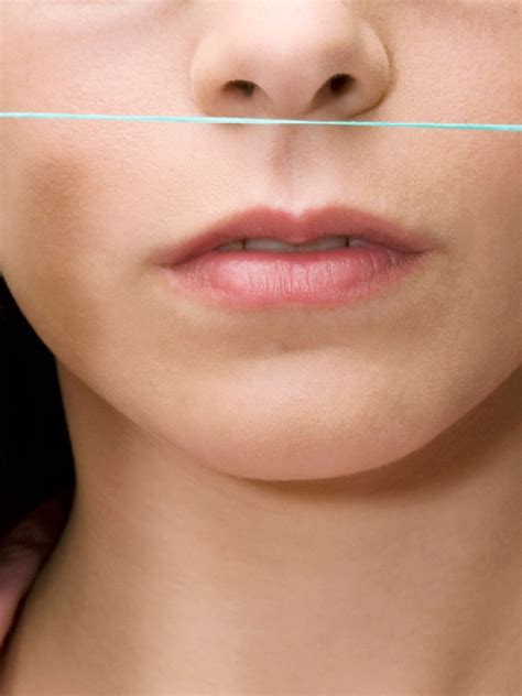 Blackheads around mouth could be caused by your favorite balm