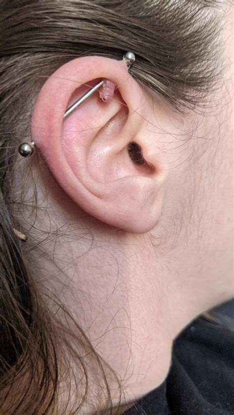 How To Clean Industrial Piercing Bump at Gladys Davy blog