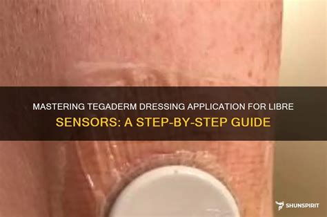 Mastering Tegaderm Dressing Application For Libre Sensors: A Step-By