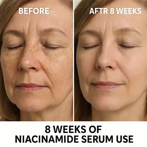 niacinamide serums  aging skin  products tested