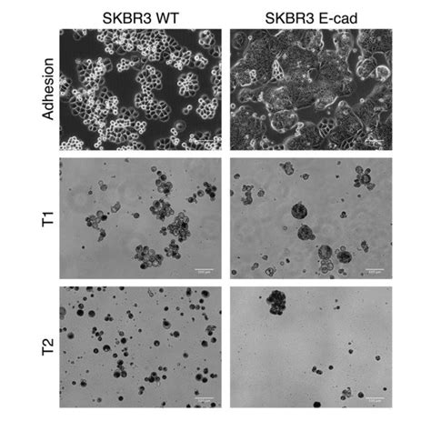 immunofluorescence staining  skbr  cadherin  wt cells showing