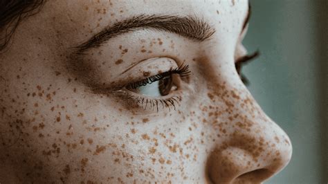 fascinating science    freckles allure