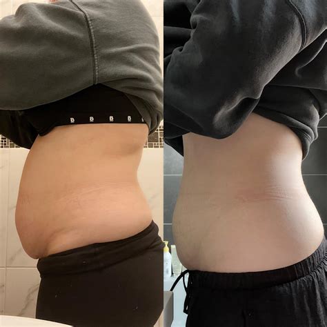 12 Weeks Postpartum Belly Best Pregnancy Support Belt 2024: Maximum