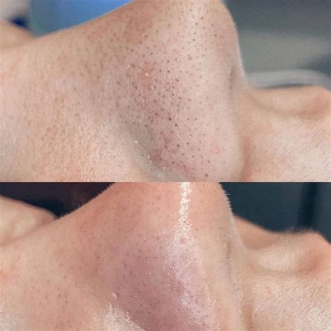 medical aesthetic center hydrafacial