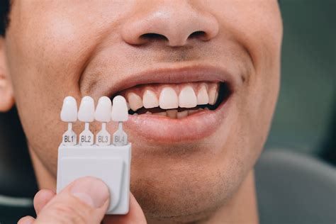 How to Care for Your Veneers and Keep Them Looking Natural - Silver