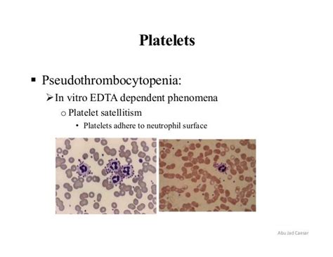 Blood film preparation and reporting