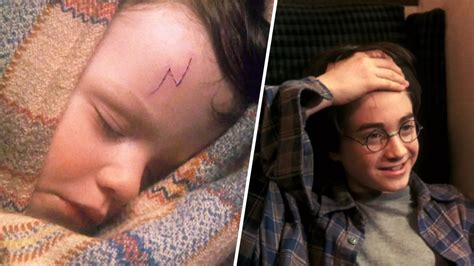 Harry Potter Cicatriz
