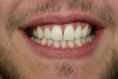 Tooth Talk | Dentist in Bolton, Staffordshire, Southport, Salisbury