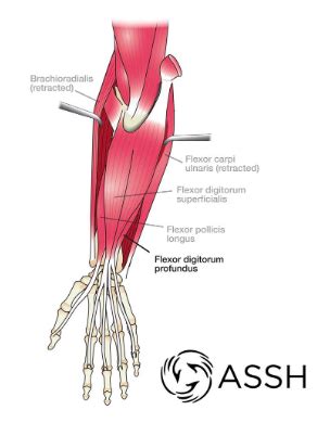 Jersey Finger – Carolyn Yang, MD