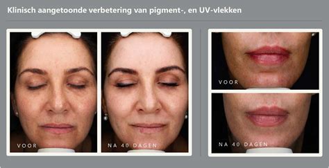 Dermaquest Active Retinol Repair Serum 1% - Online bestellen - Derma ...