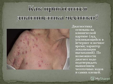 Презентация на тему: "Чесотка – это заболевание кожи, вызываемое ...
