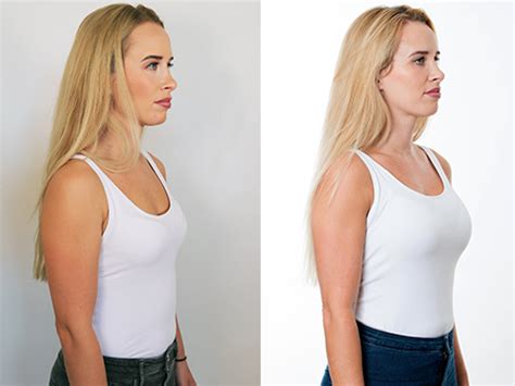 What Grace Charis's Boob Job Can Teach You About Cosmetic Surgery. - 2w48g89