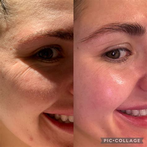 LED Face Mask | Red Light Therapy Mask | CurrentBody USA