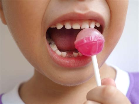 How does sugar cause tooth decay? - Ravenscourt Dental Practice