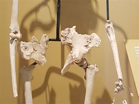 homo floresiensis skeleton  study reveals archaic hobbits
