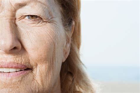 revitalizing sun damage  skin aging treatments dermetics