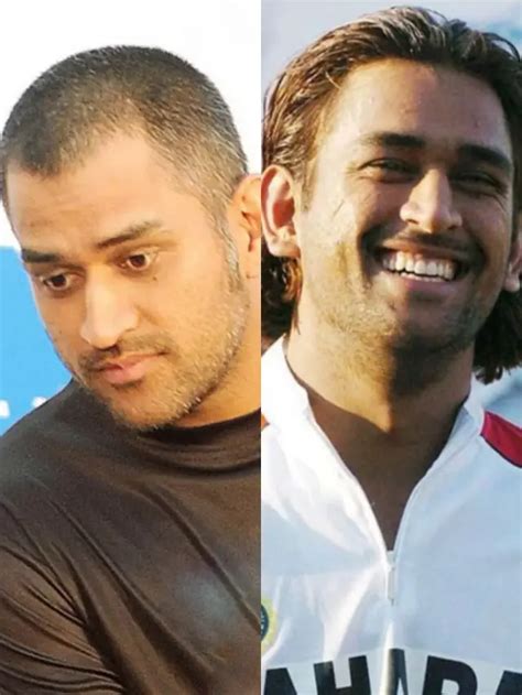 MS Dhoni’s Hair Transplant & The Story Behind His New Look - Best Hair ...