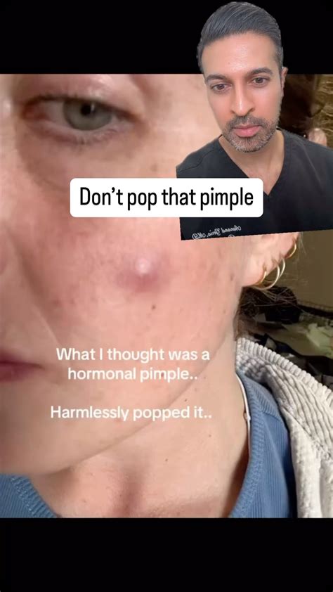 Aanand Geria, MD FAAD (@drgeria) • Instagram photos and videos