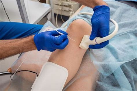 Vein Ablation Recovery: Top 8 Tips to Manage Pain and Discomfort