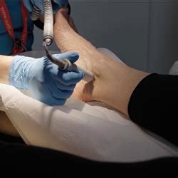 diabetic foot management  practice clinical assessment  intervention