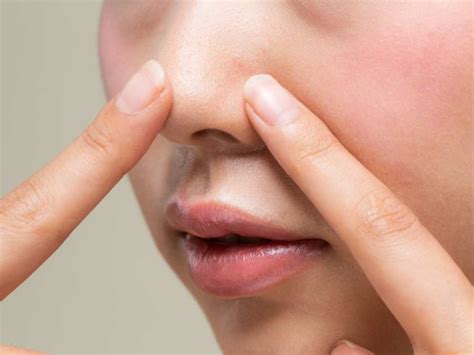 langkah mudah basmi komedo  mungkin  kamu ketahui beauty journal