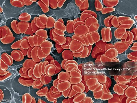 blood clot high res stock photo getty images
