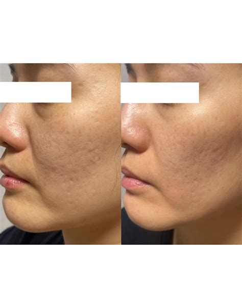 Lumi. (@lumi.secret) • Instagram photos and videos