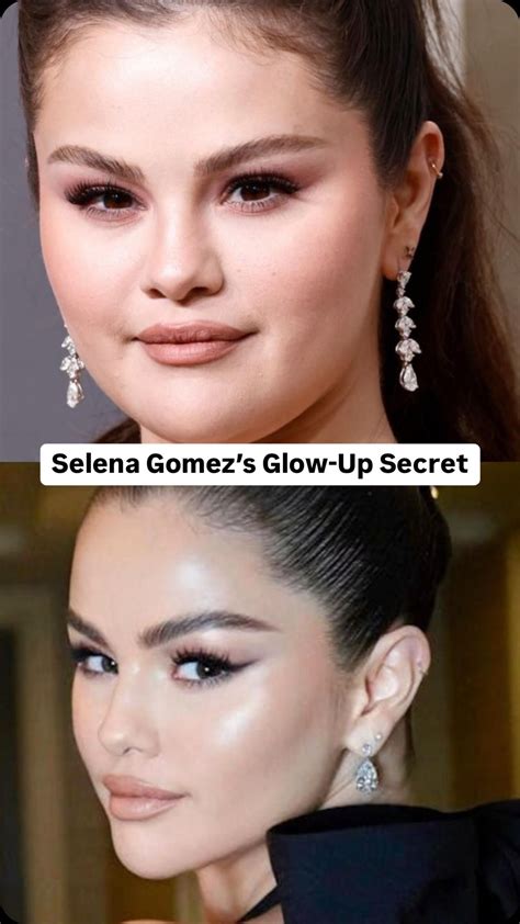 Selena Gomez before and after plastic surgery in 2025 | Plastic surgery