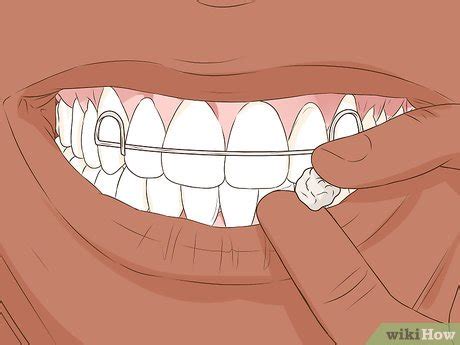 How to Heal a Bitten Tongue: First Aid & Treatment