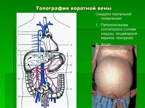 Топографическая анатомия брюшной полости. Границы области, деление на ...